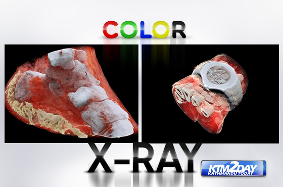 color-xray